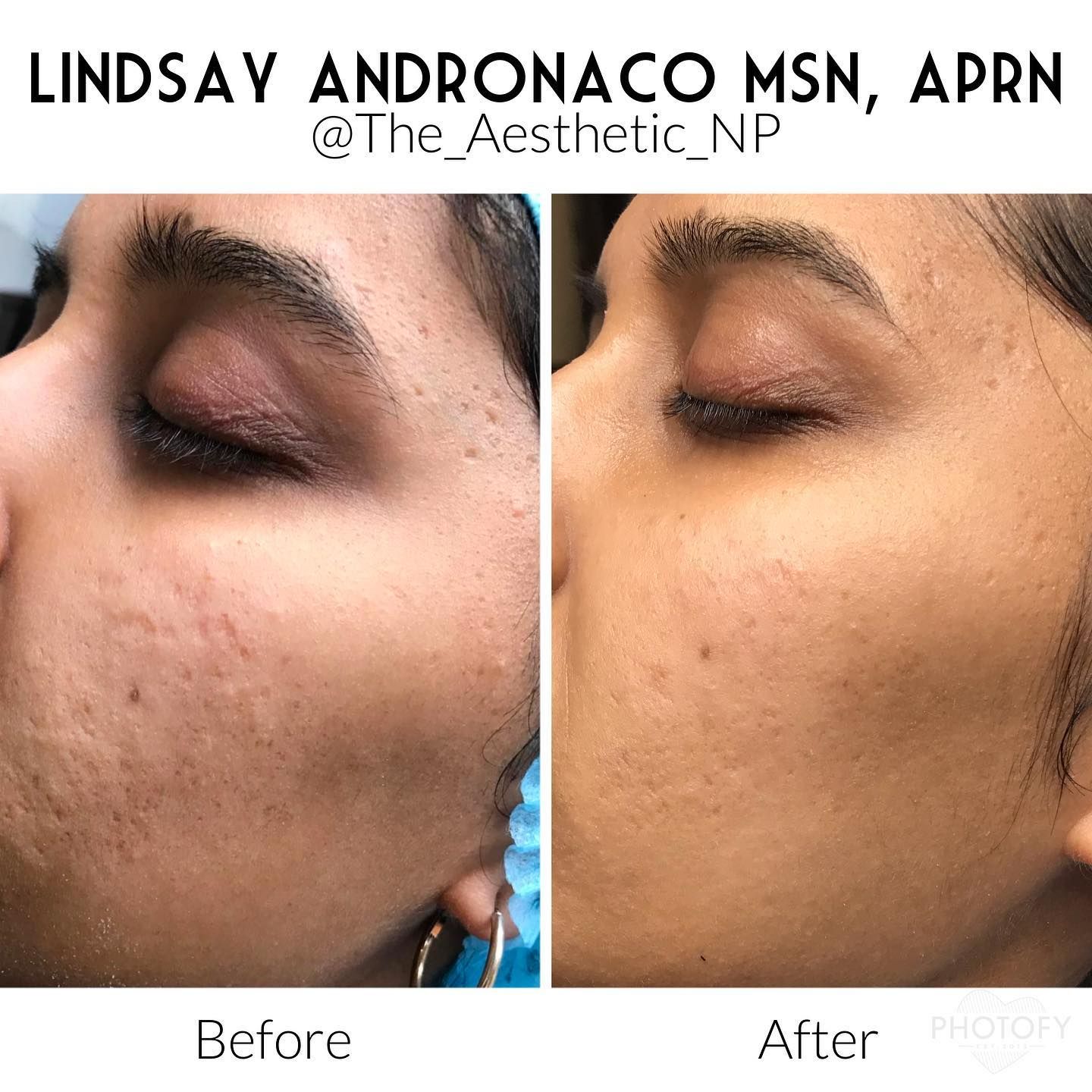 A before and after photo of a woman 's face.