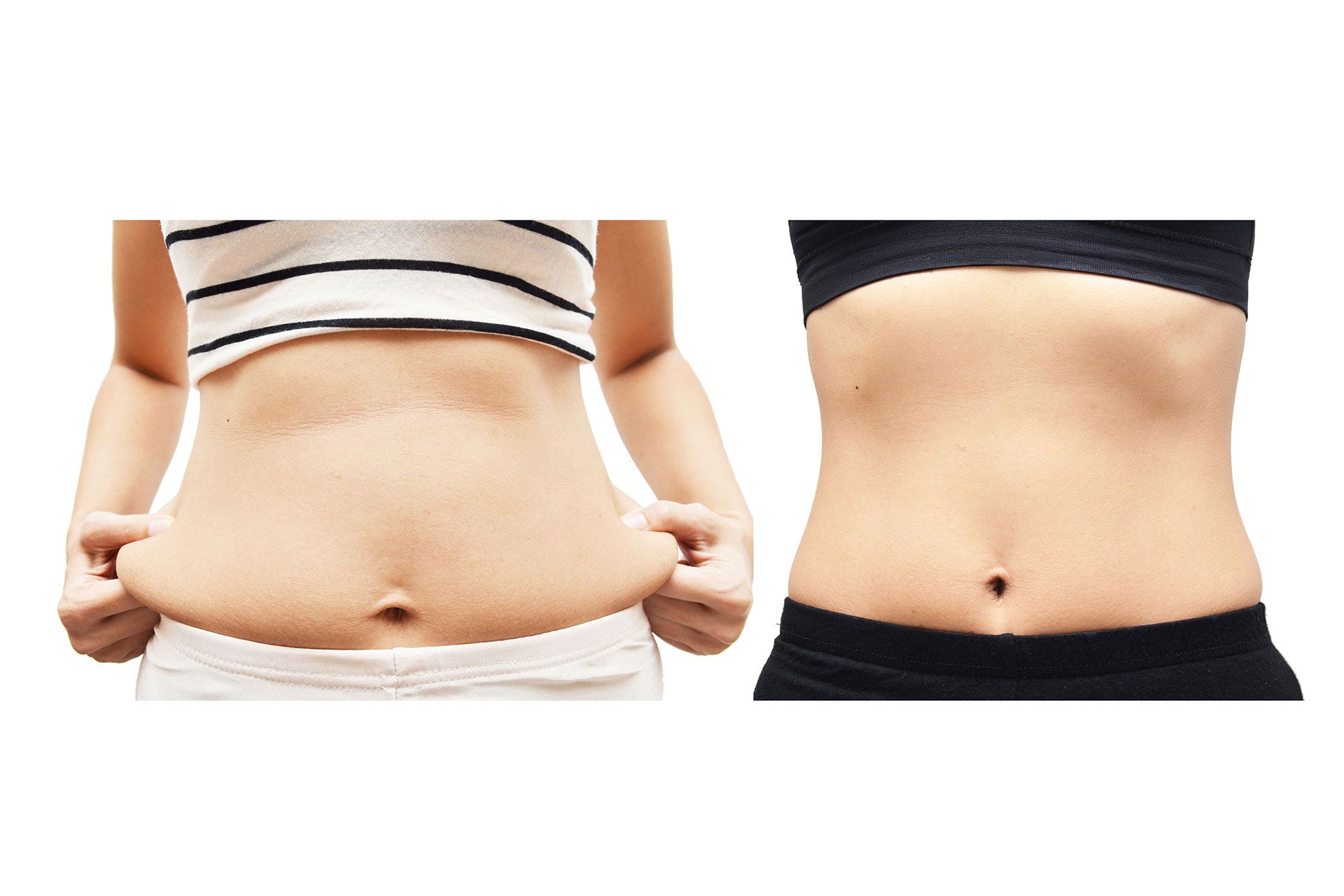 Before and after image of a stomach