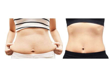 Before and after stomach picture
