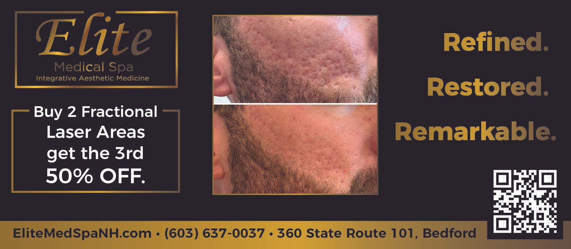 Ad for Elite Medical Spa, with body transformation offers. Includes before/after photo, event info & QR code.