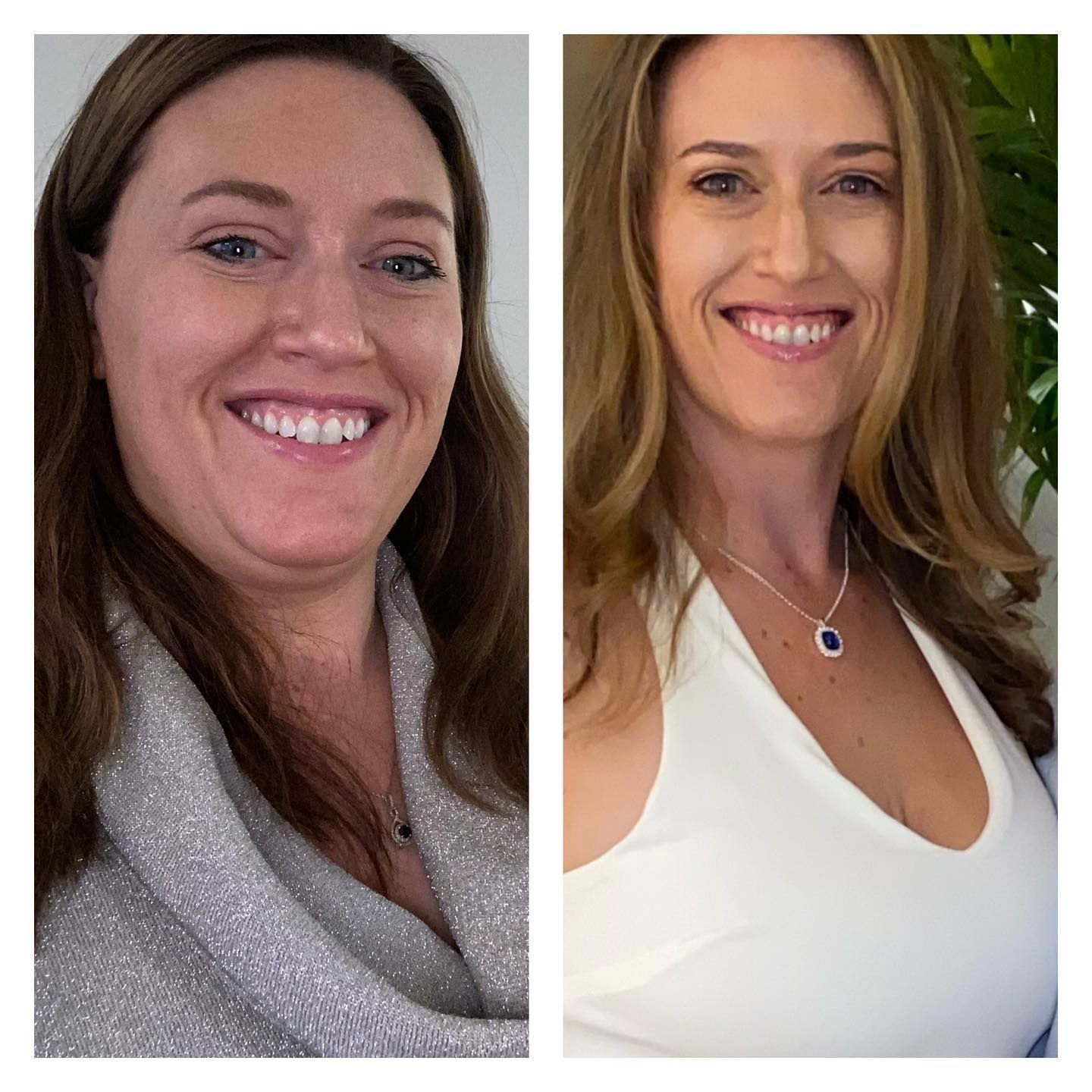 A before and after photo of a woman smiling.