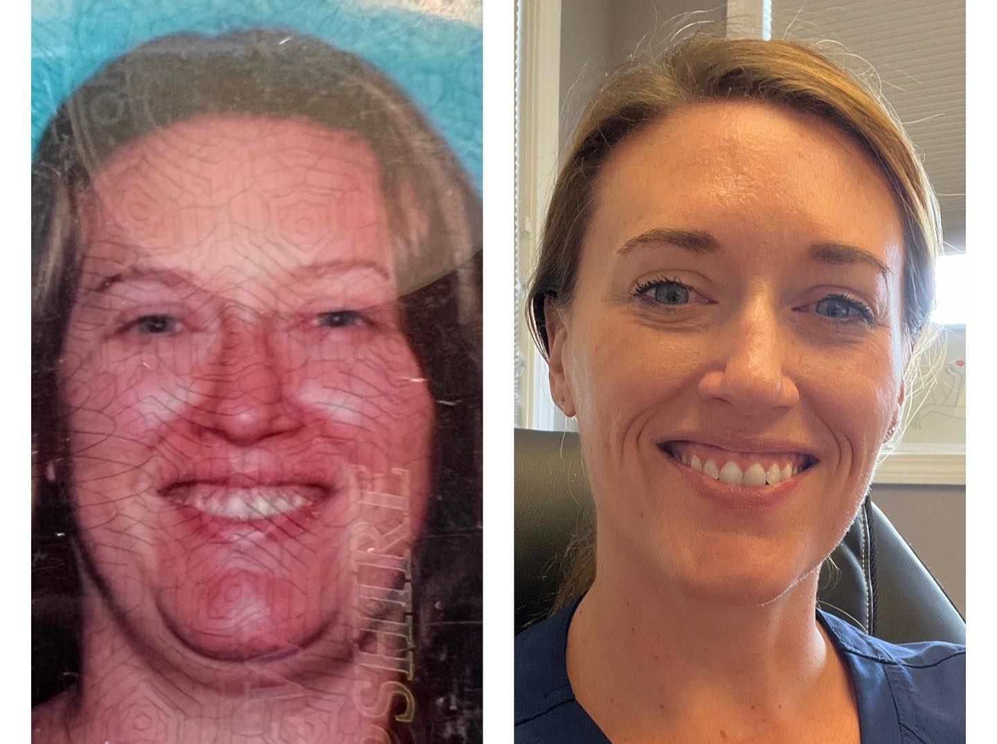 A woman is smiling in a before and after photo.
