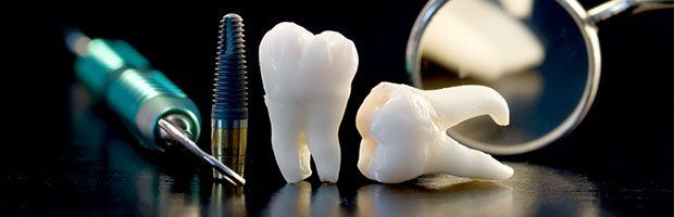 dental Implant