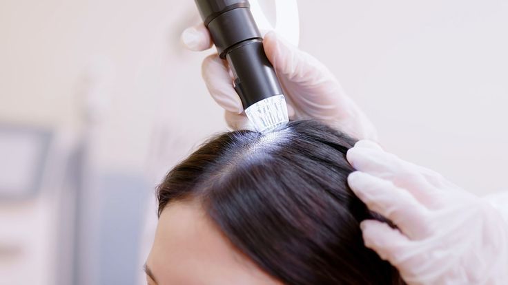 Gloved hands examining scalp with a small device on dark hair roots in a clinic setting.