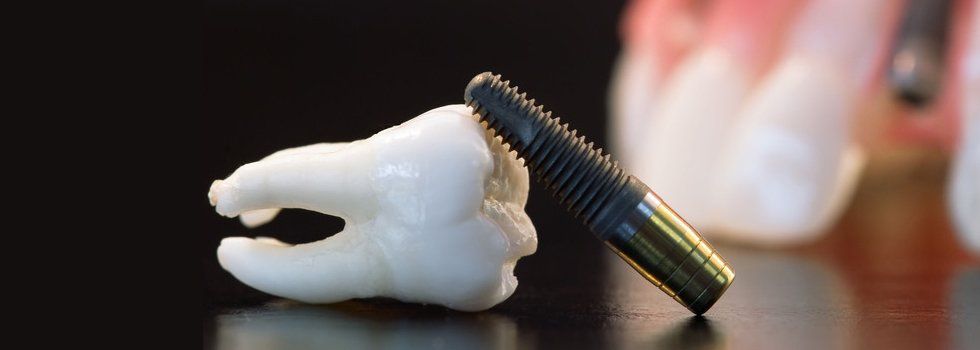 Tooth for dental implant