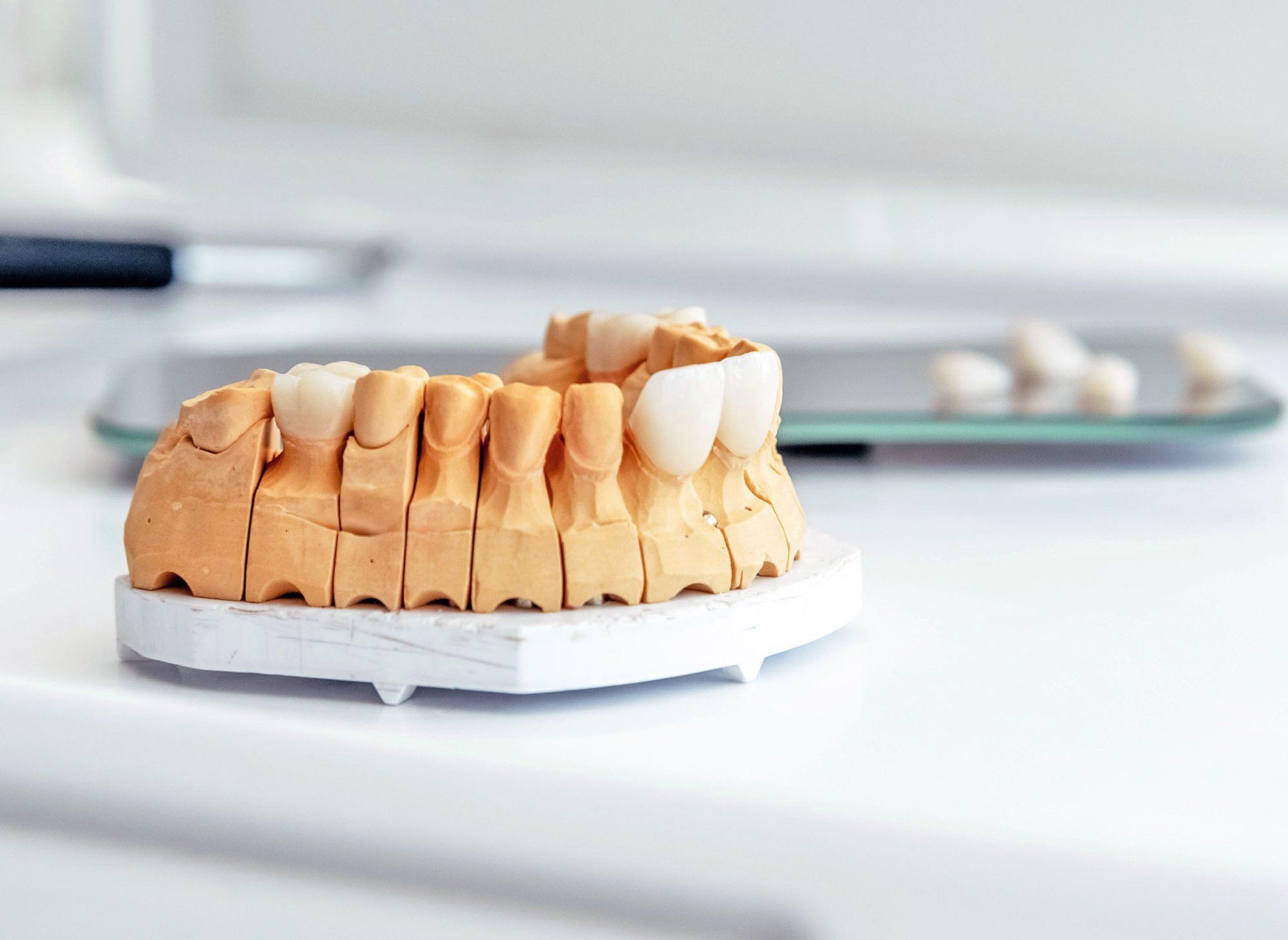 CEREC Crowns