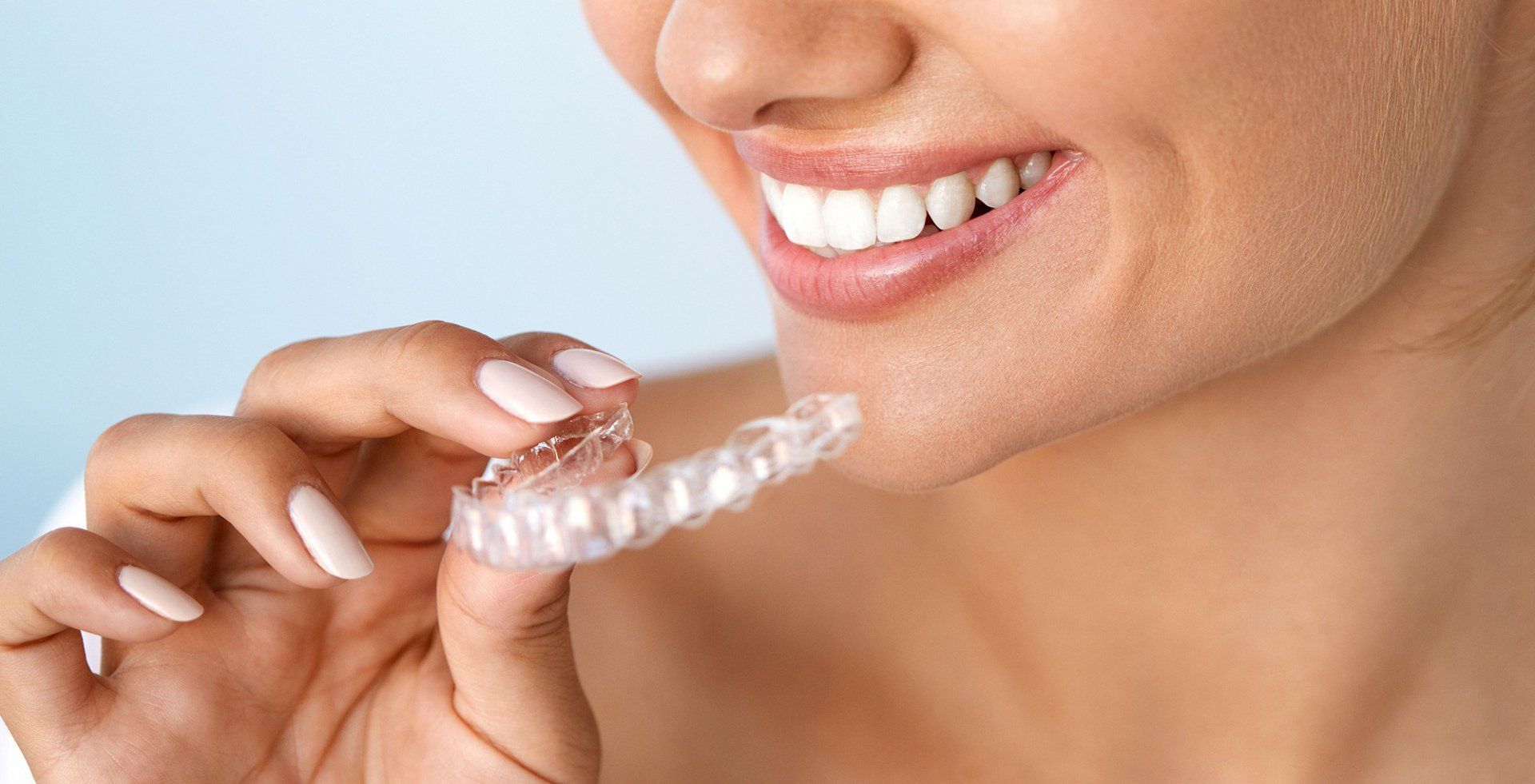 Clear Aligners