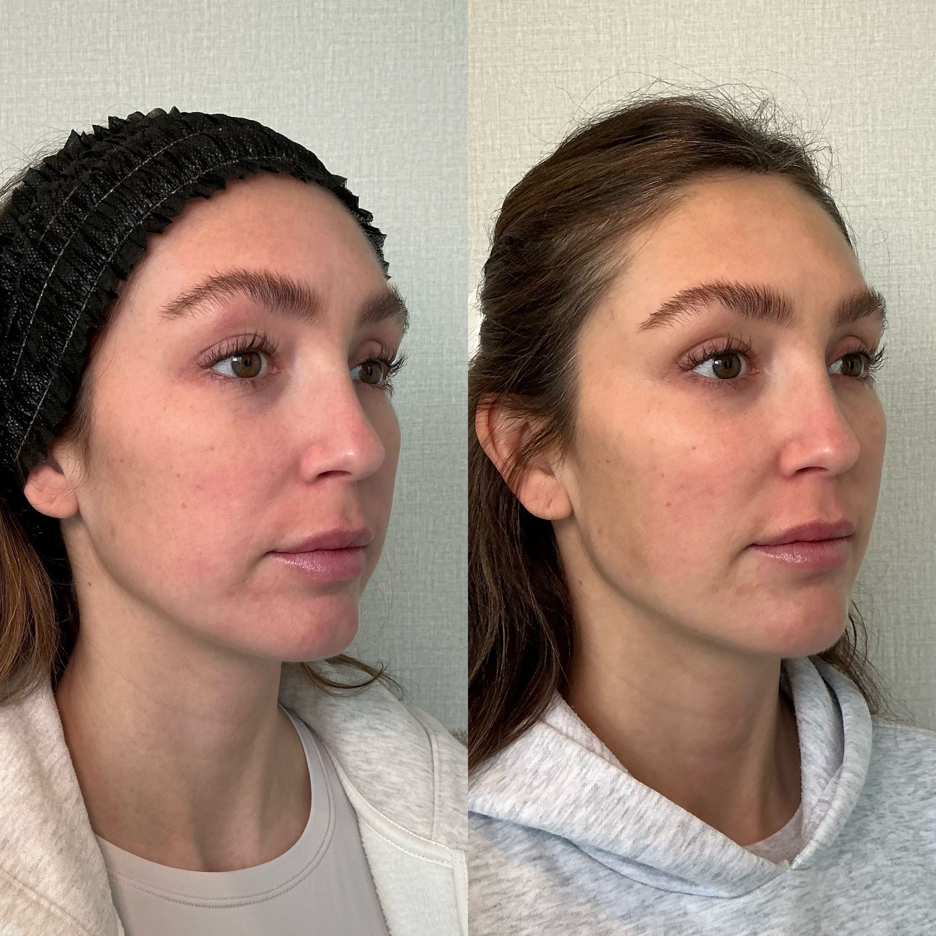 Side-by-side profile photos of the same woman in a black beanie and white hoodie against a plain wall