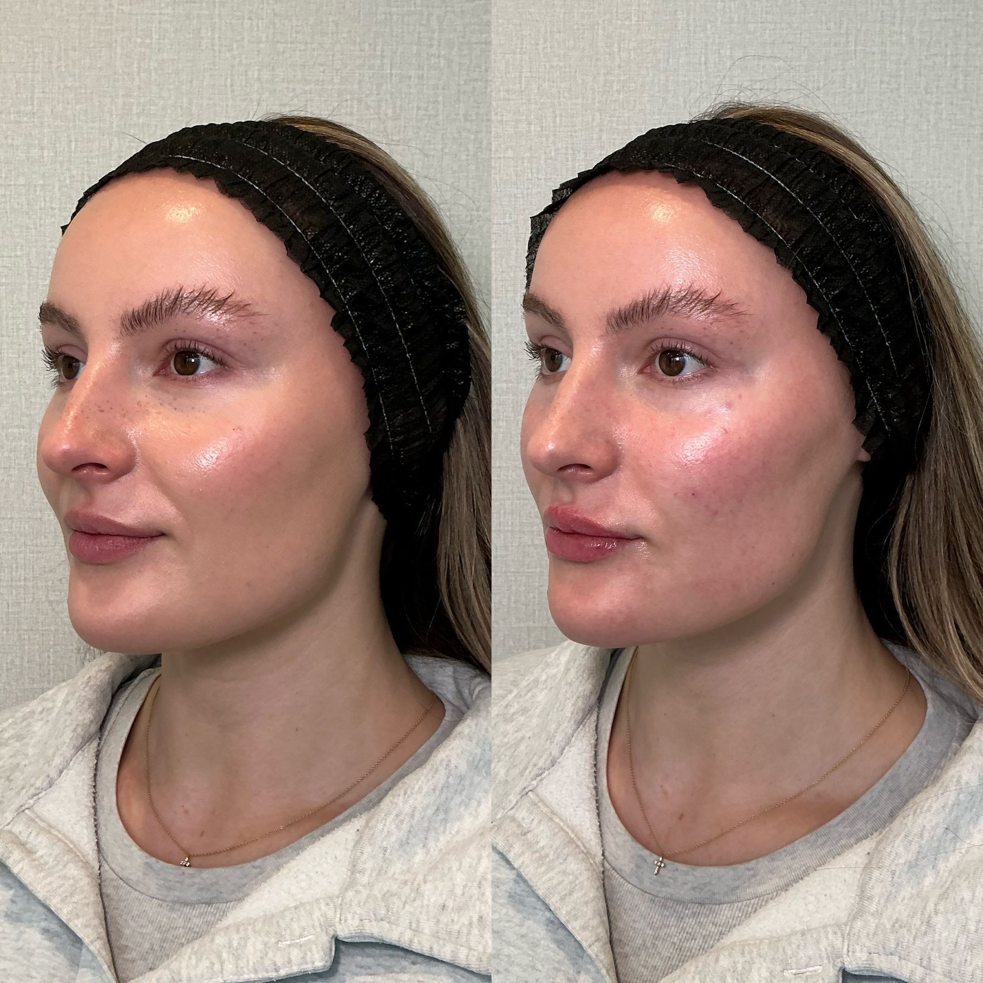 Side-by-side profile portraits of a woman wearing a black headband and light gray top, softly lit indoors