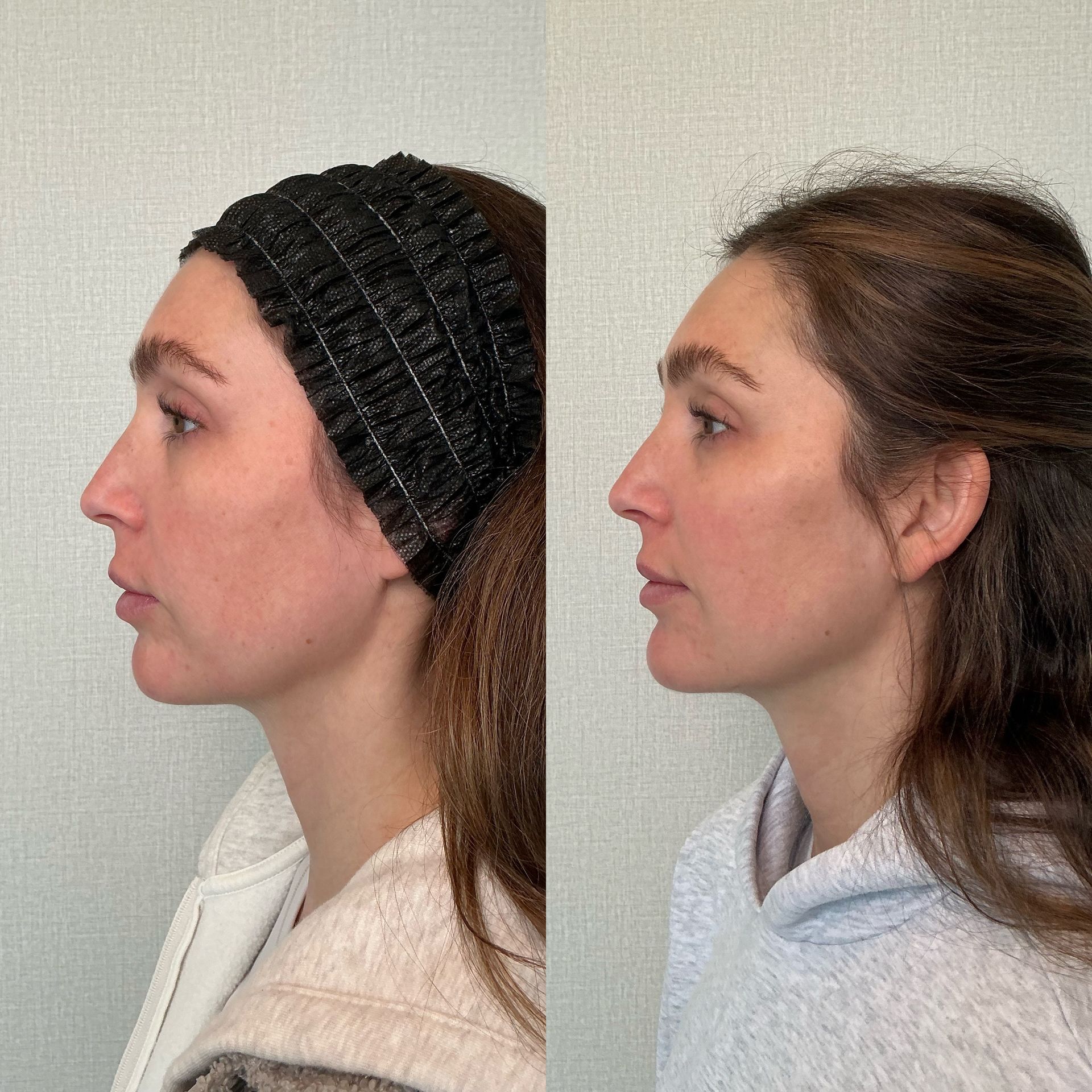 Side-by-side profile portraits of a woman, one with a black knit headband and one with loose hair.
