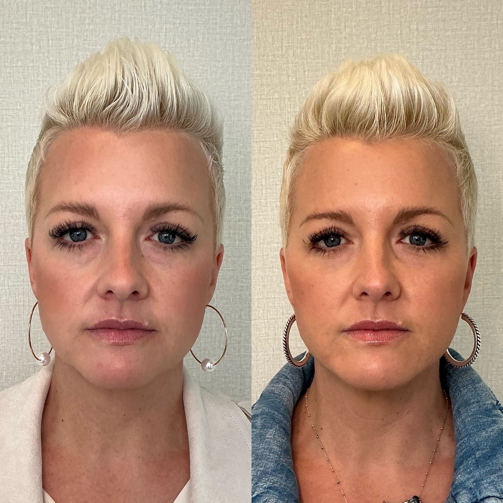 Side-by-side portrait of the same person with short blonde hair, neutral expression, against a plain background