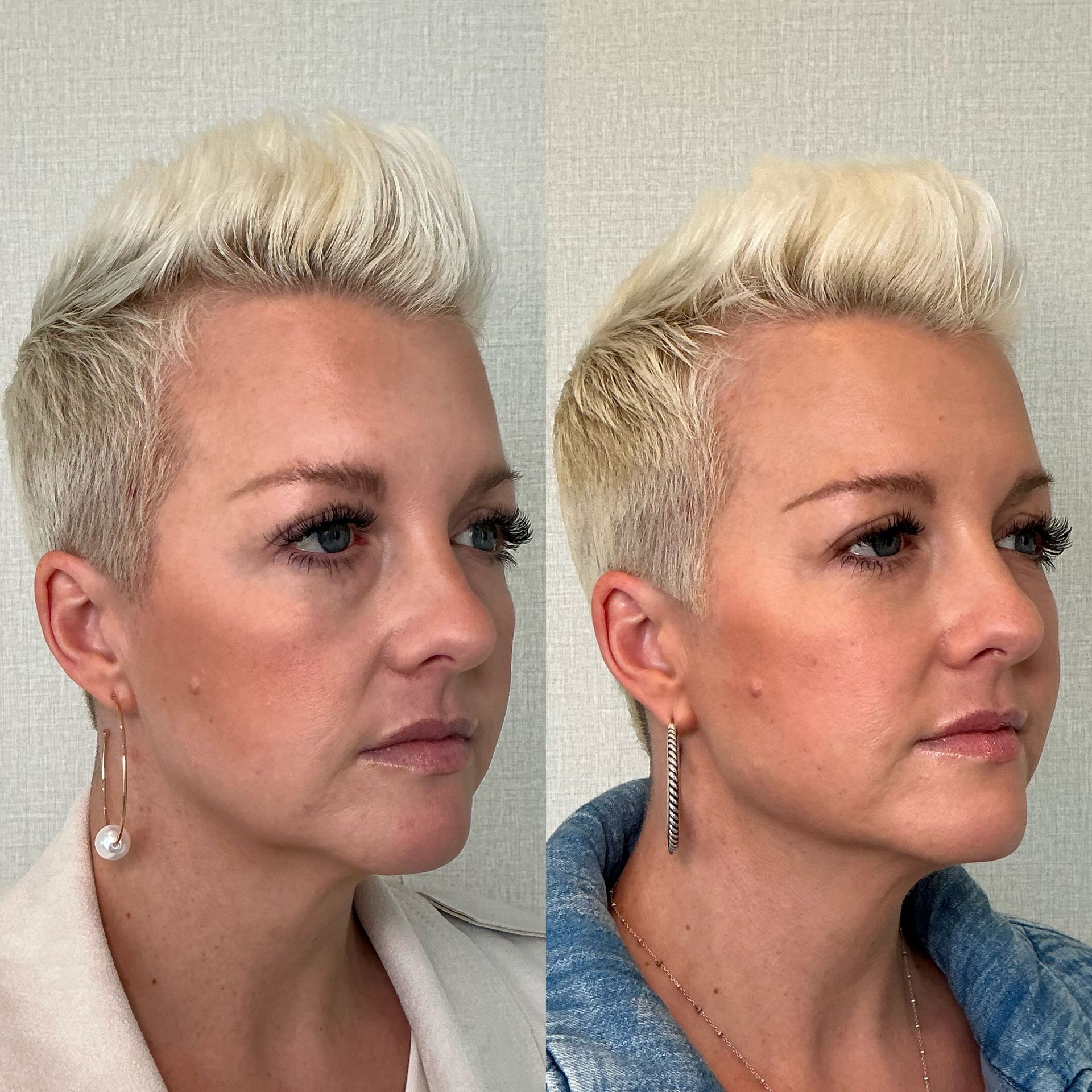 Side-by-side portrait of the same person with short platinum hair, wearing different tops against a plain background