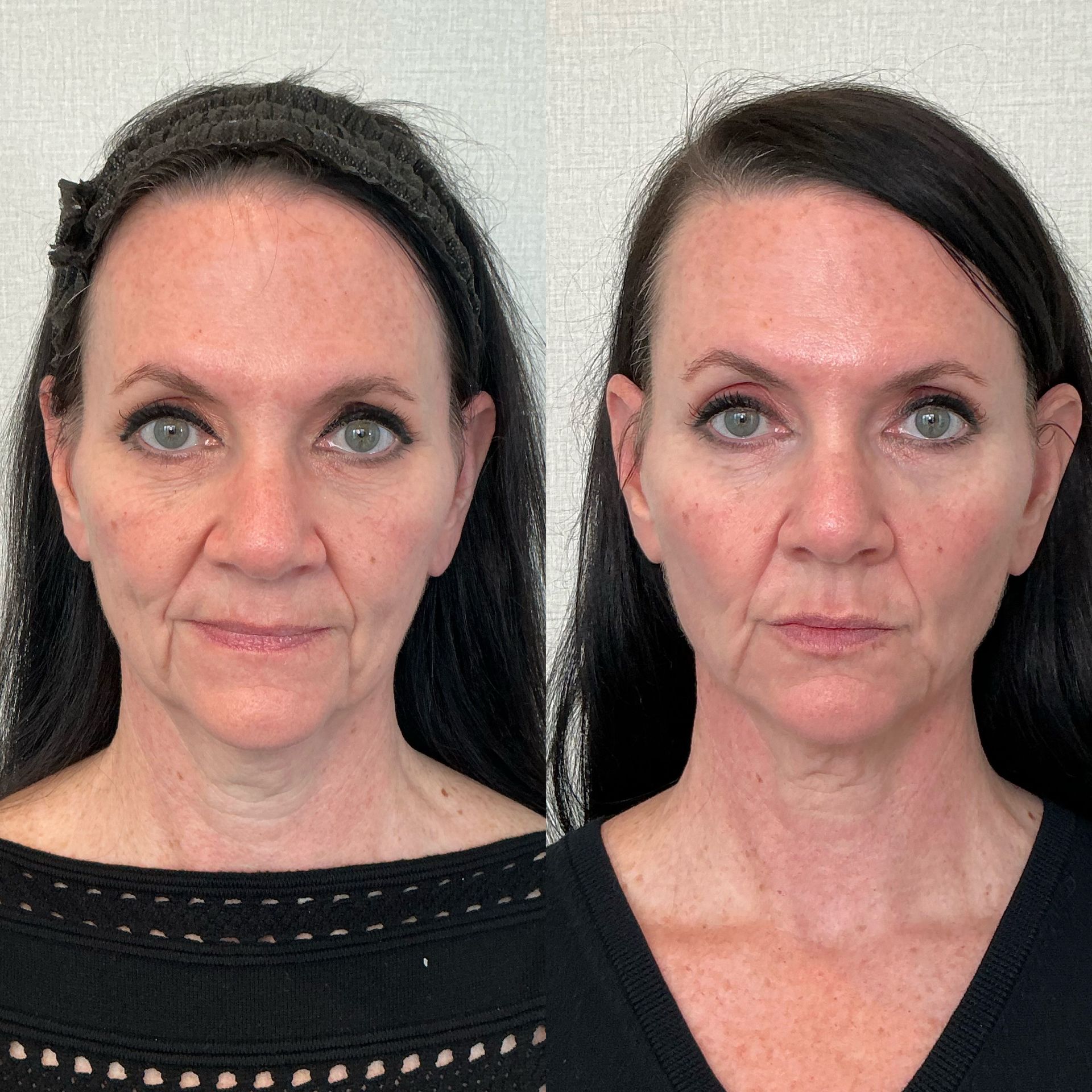 Side-by-side portrait of the same woman, showing before-and-after face makeup or skin changes on a plain background