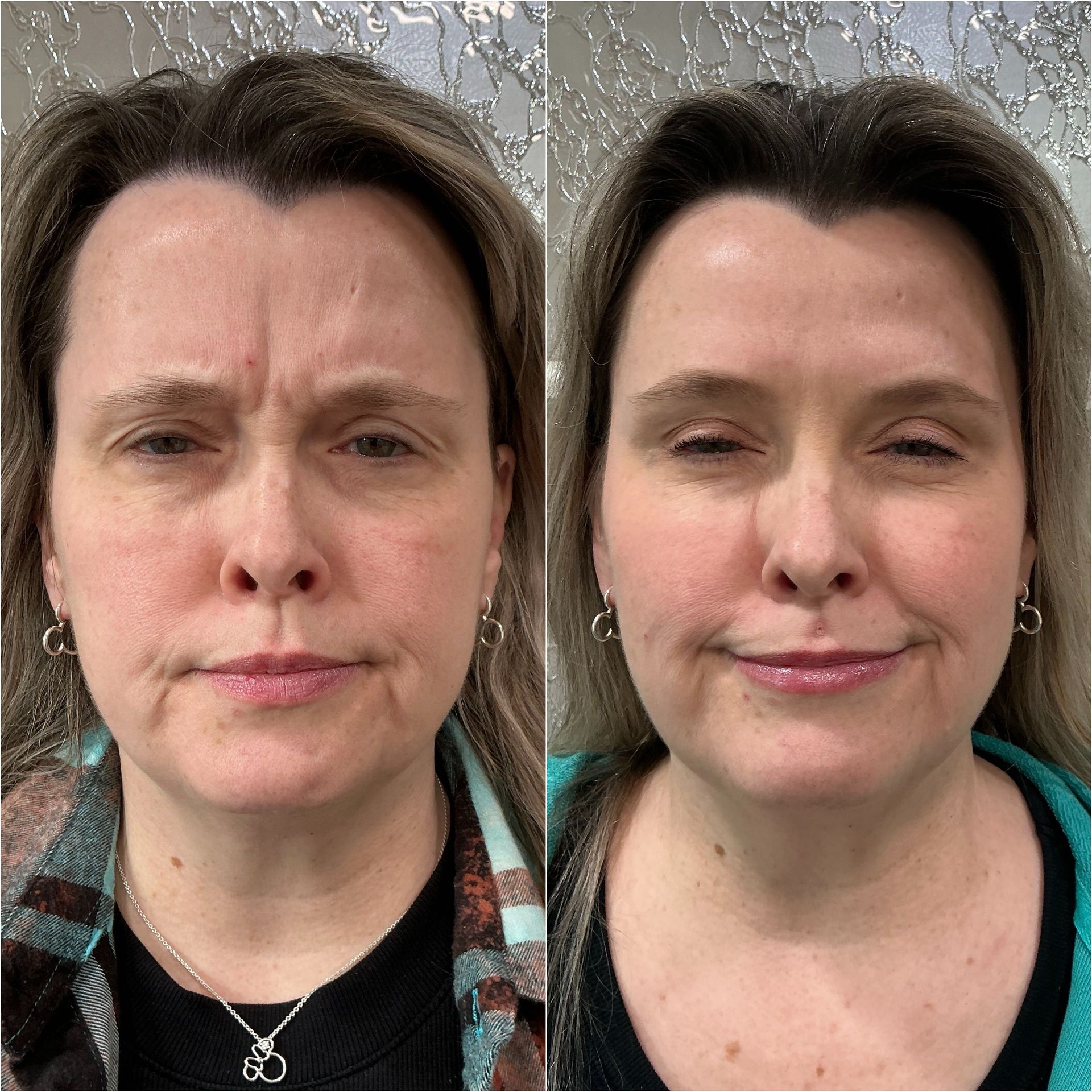 Two side-by-side portrait photos of the same woman, one with a neutral face and one smiling softly.
