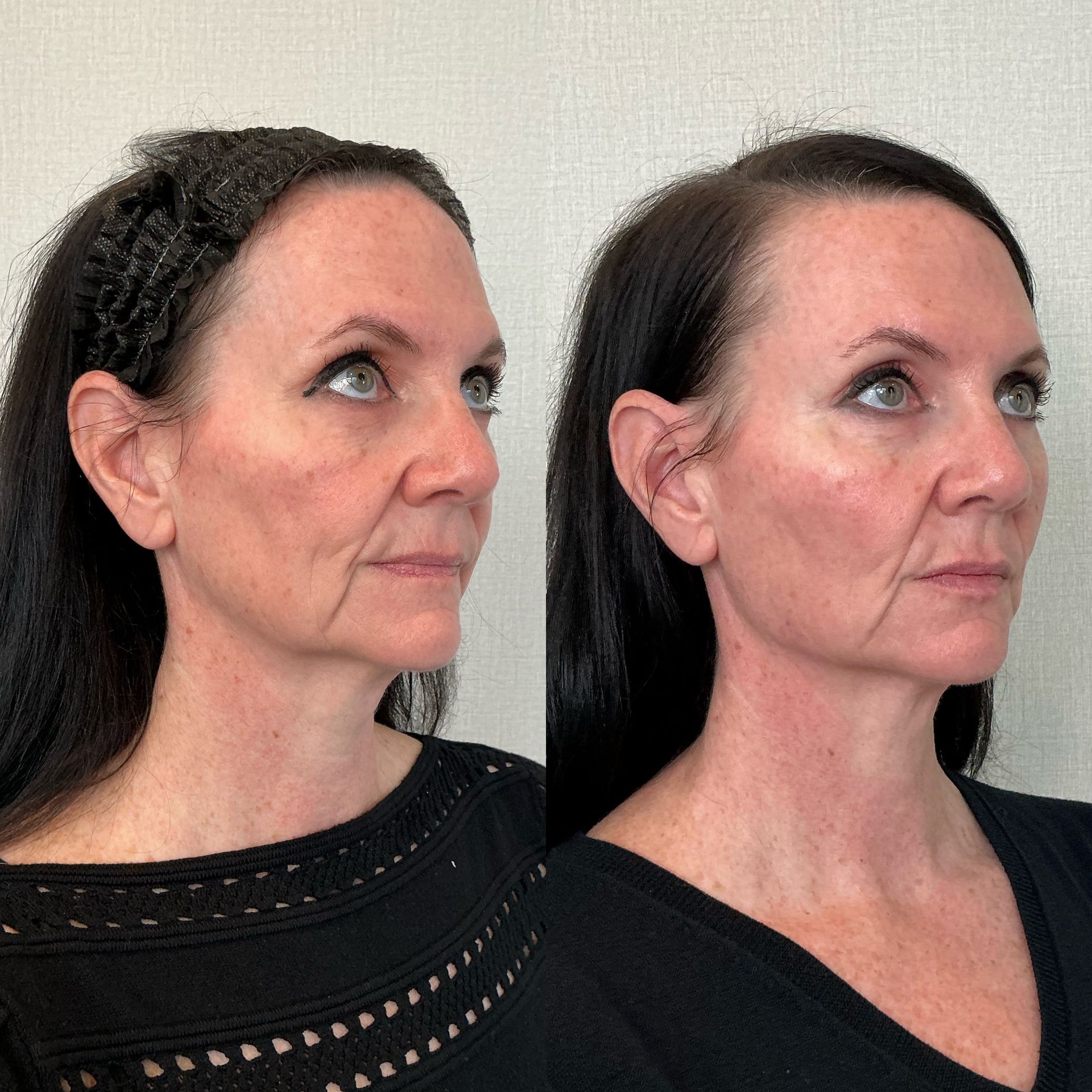 Side-by-side portraits of a woman in a black top, looking upward against a plain background