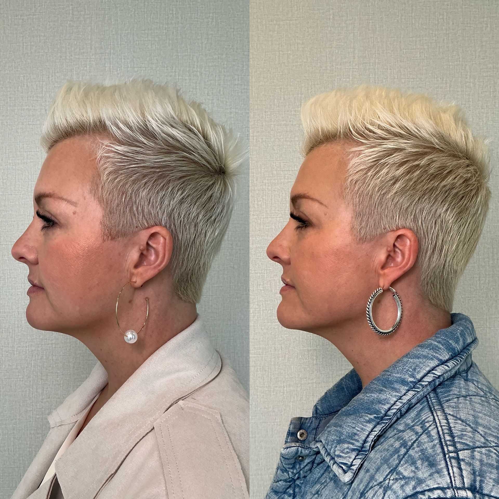 Side-by-side profile photos of a short platinum-blonde haircut, shown on a neutral background.