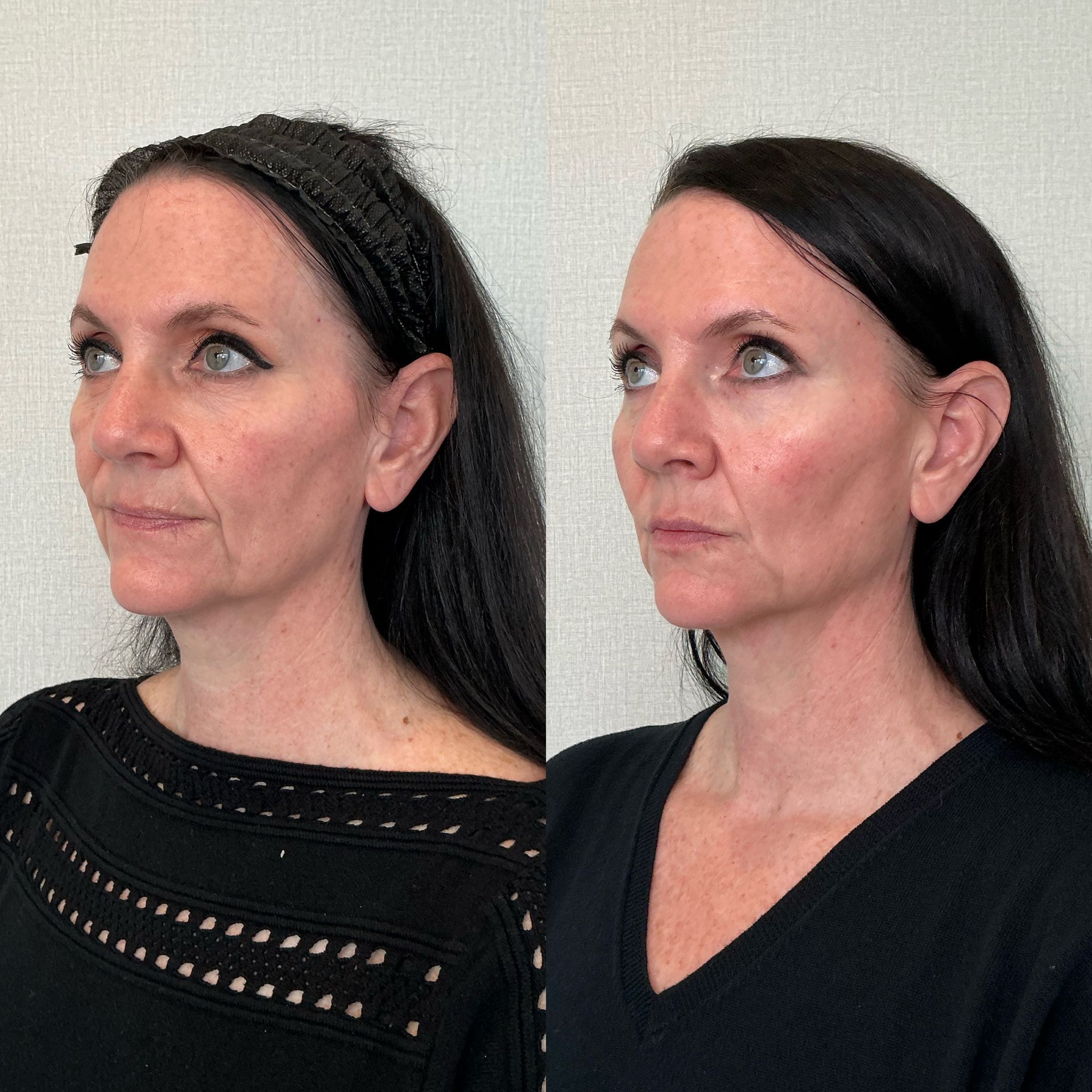 Side-by-side profile portraits of a woman with black hair against a plain white background