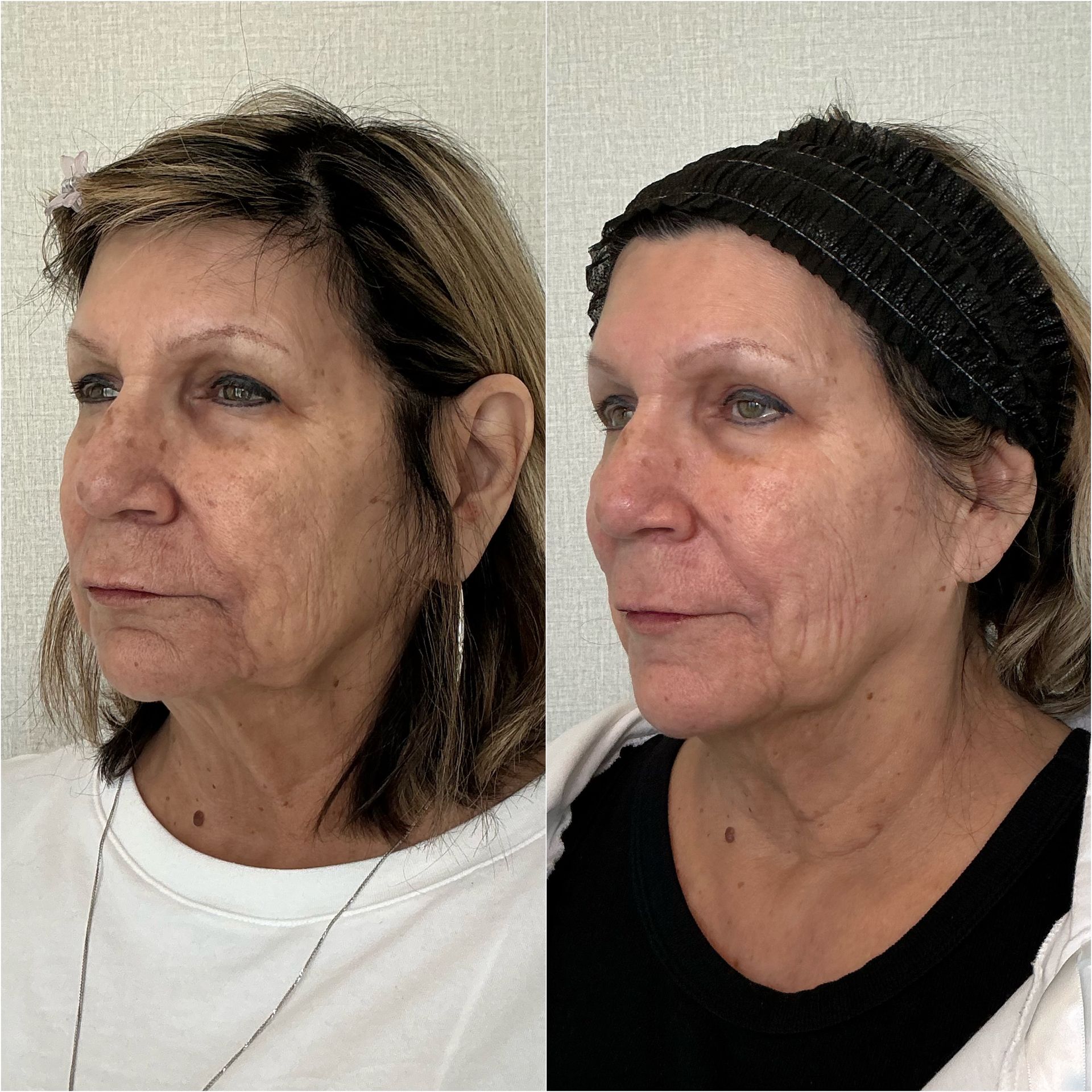 Side-by-side portrait of the same woman with and without a black knit cap, in a white-background studio setting