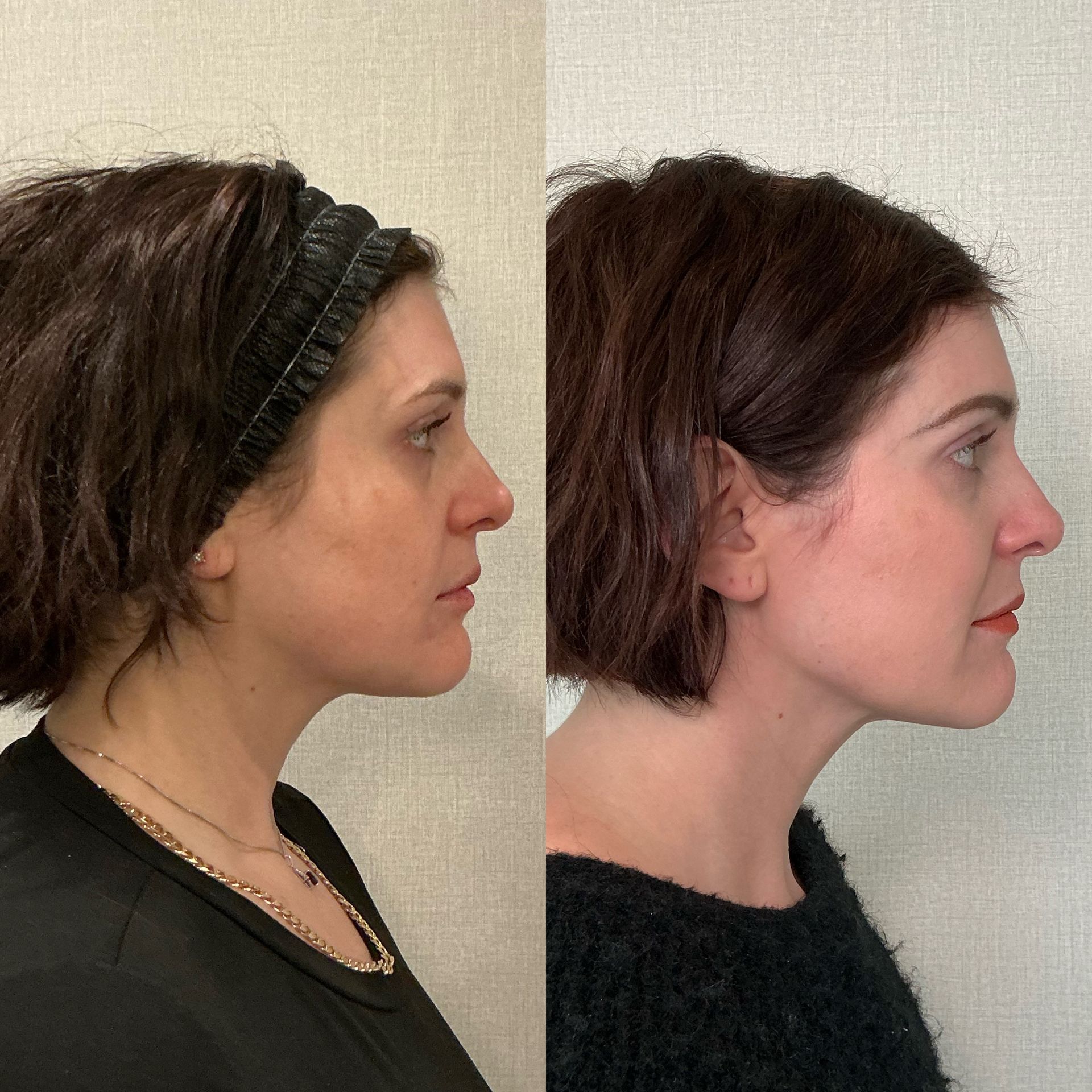 Side-by-side profile portraits of the same person, one in a dark top with headband and one in a black sweater.