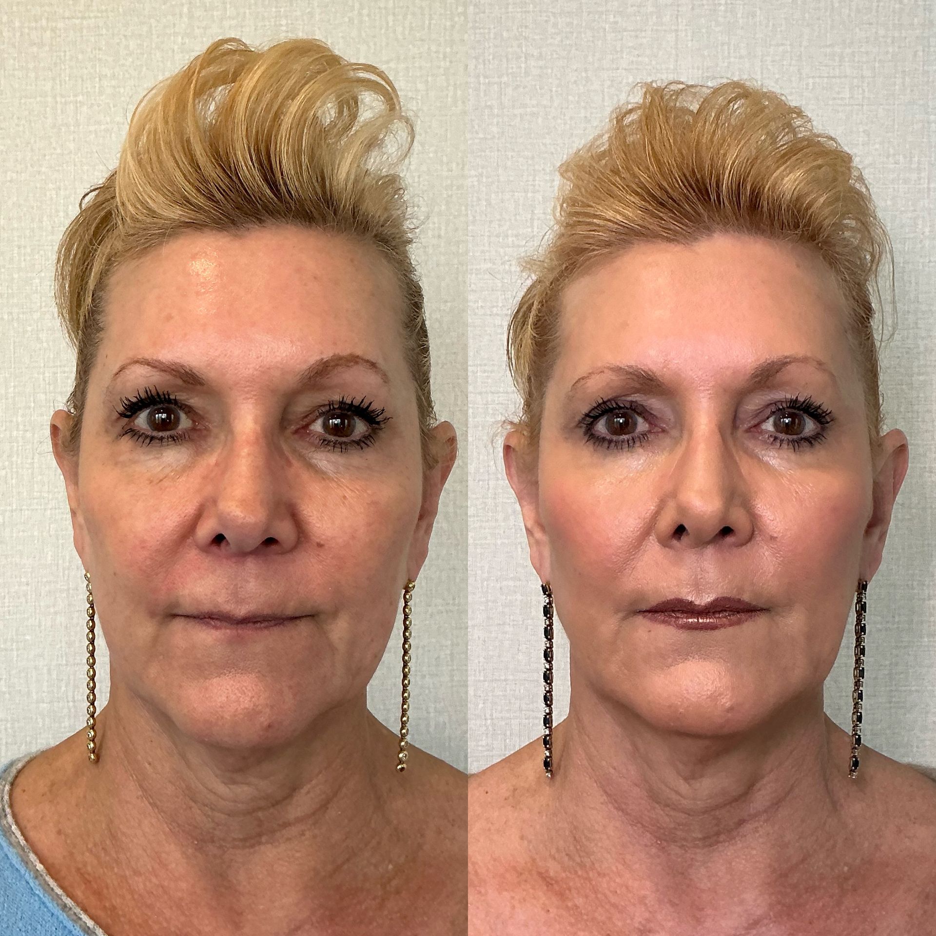 Two side-by-side portraits of the same woman with a blonde updo, neutral expression, against a plain background.