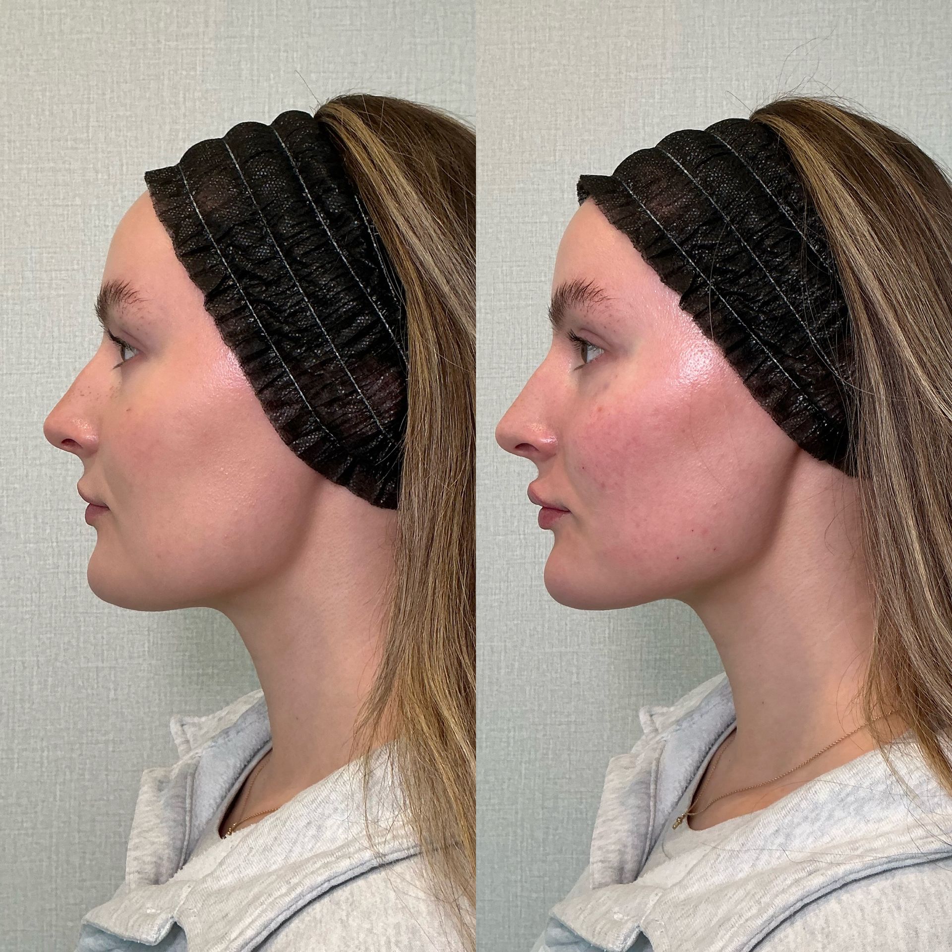Side-by-side profile portraits of a woman wearing a black headband against a neutral background