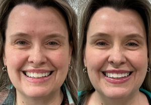 Side-by-side close-up selfies of a smiling woman, one with pink lipstick and one with bold red lipstick