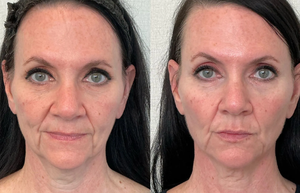 Side-by-side portrait of the same woman, showing a neutral face on the left and a more defined look on the right