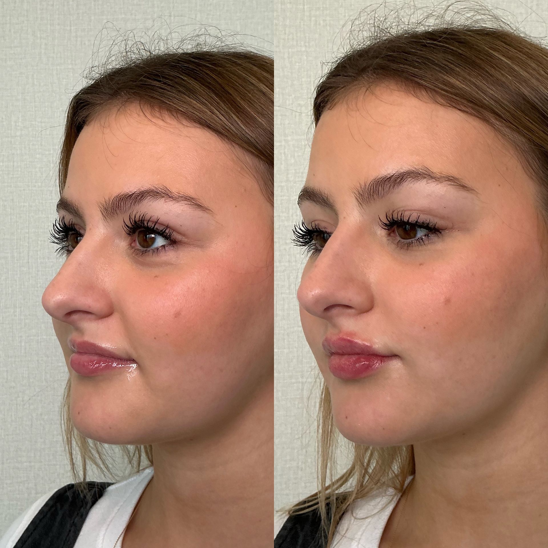 Side-by-side profile portraits of a woman with subtle makeup on a plain background