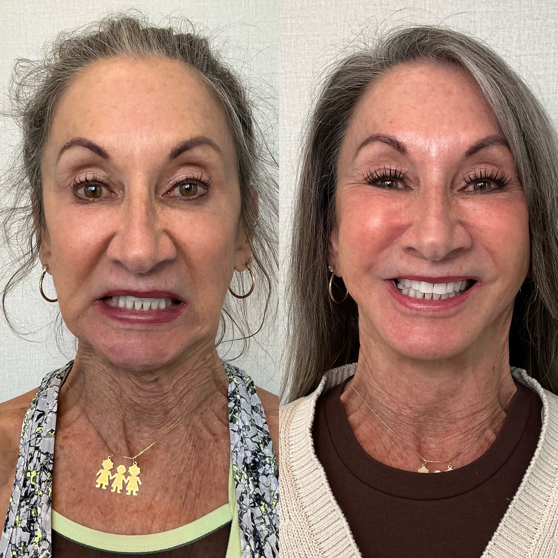 Side-by-side face photos showing before and after makeup, with a neutral expression on the left and smiling on the right