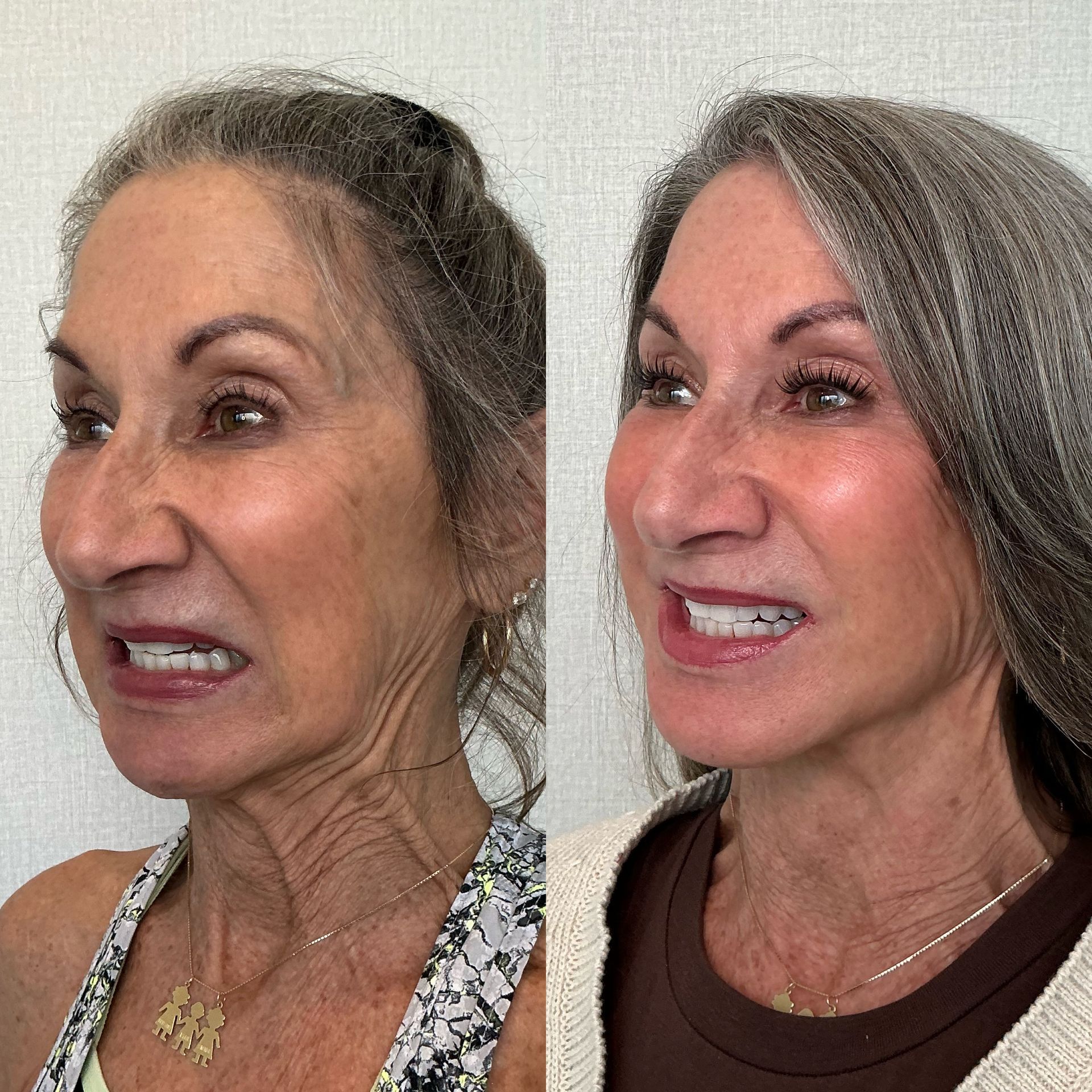 Before-and-after portrait of the same woman, showing gray hair and makeup-free face beside styled hair and makeup