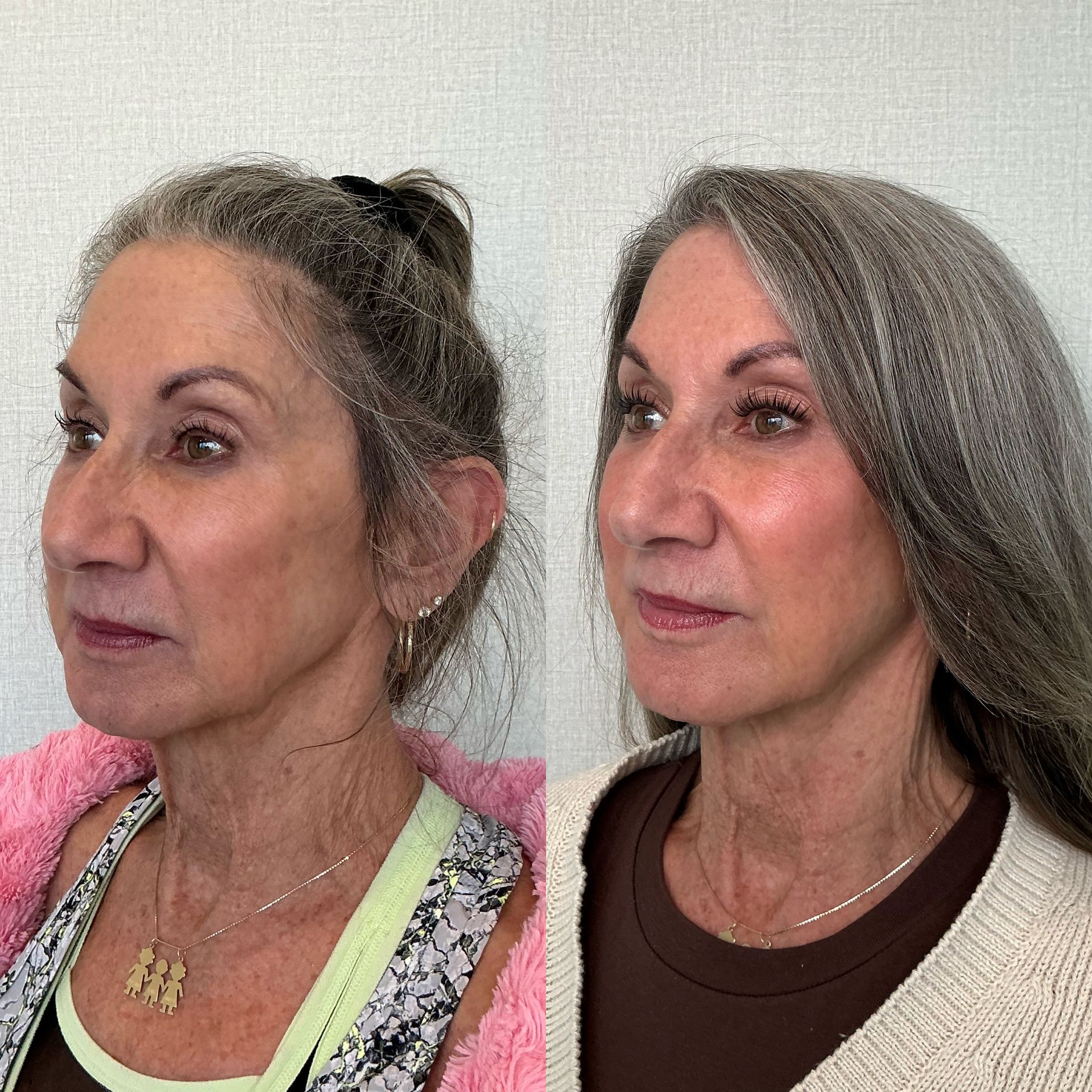 Side-by-side profile portraits of the same woman before and after gray hair styling, wearing different tops.