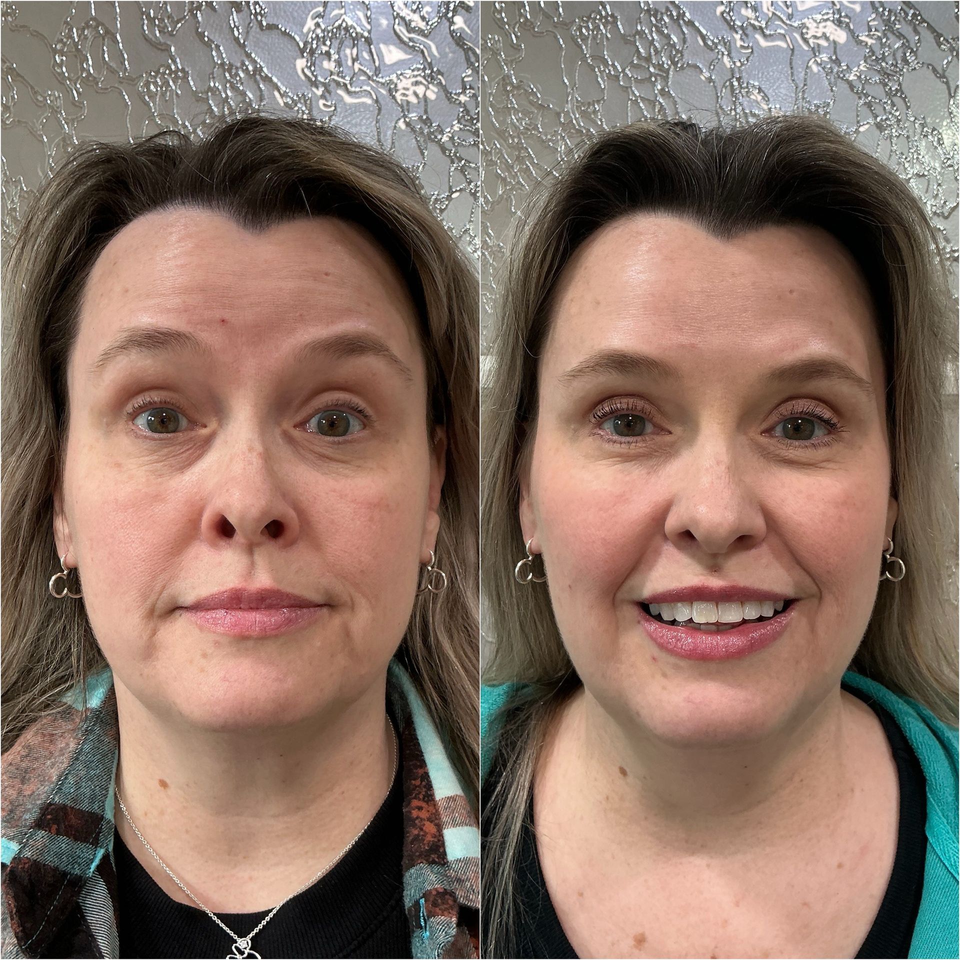 Two side-by-side selfies of the same woman, neutral on the left and smiling on the right.