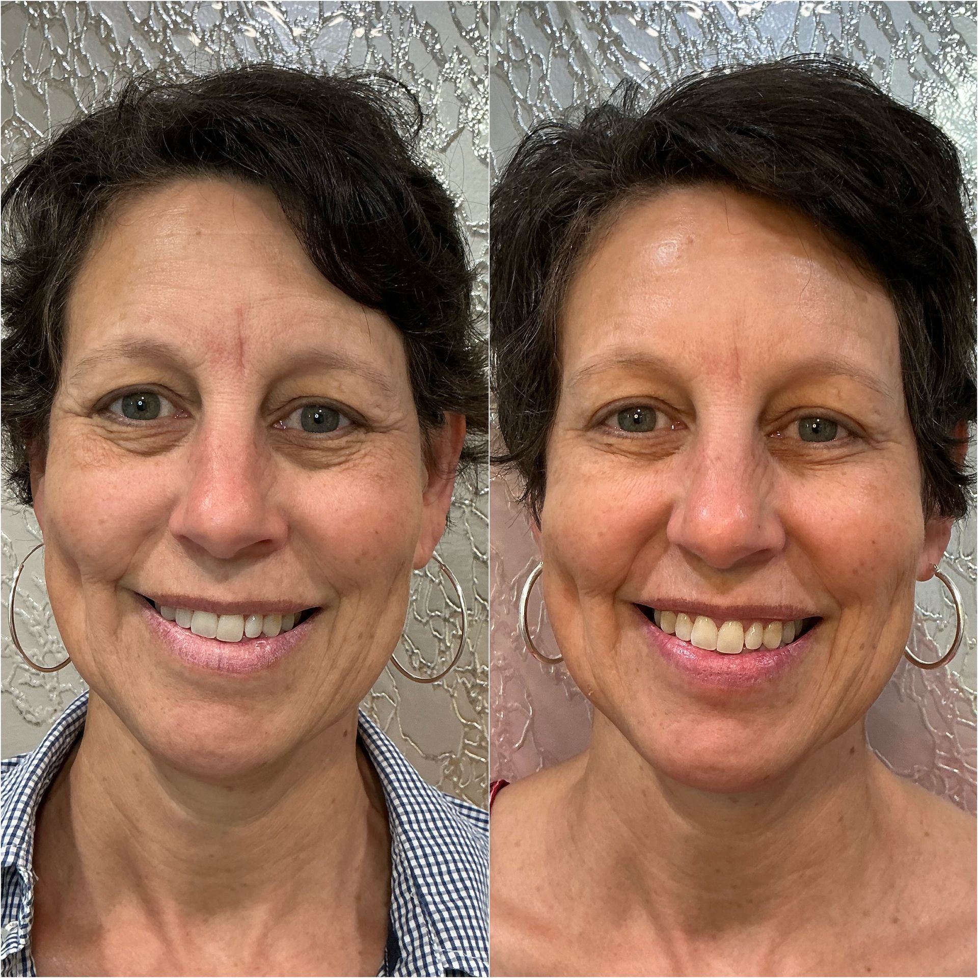 Side-by-side face comparison of the same woman with natural skin and more makeup, smiling against a textured backdrop