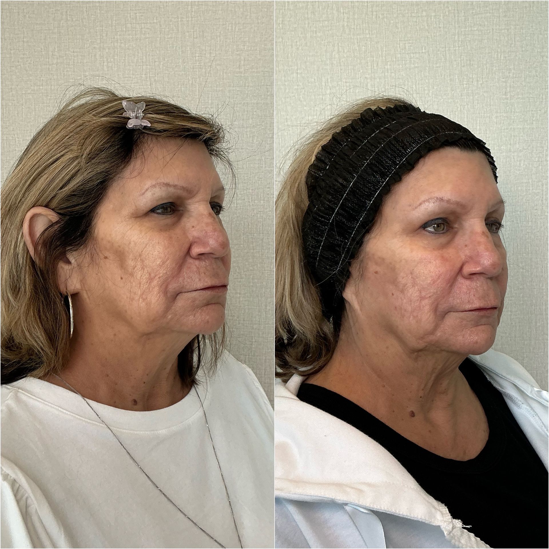 Side-by-side profile photos of a woman with short brown hair, before and after a black head wrap