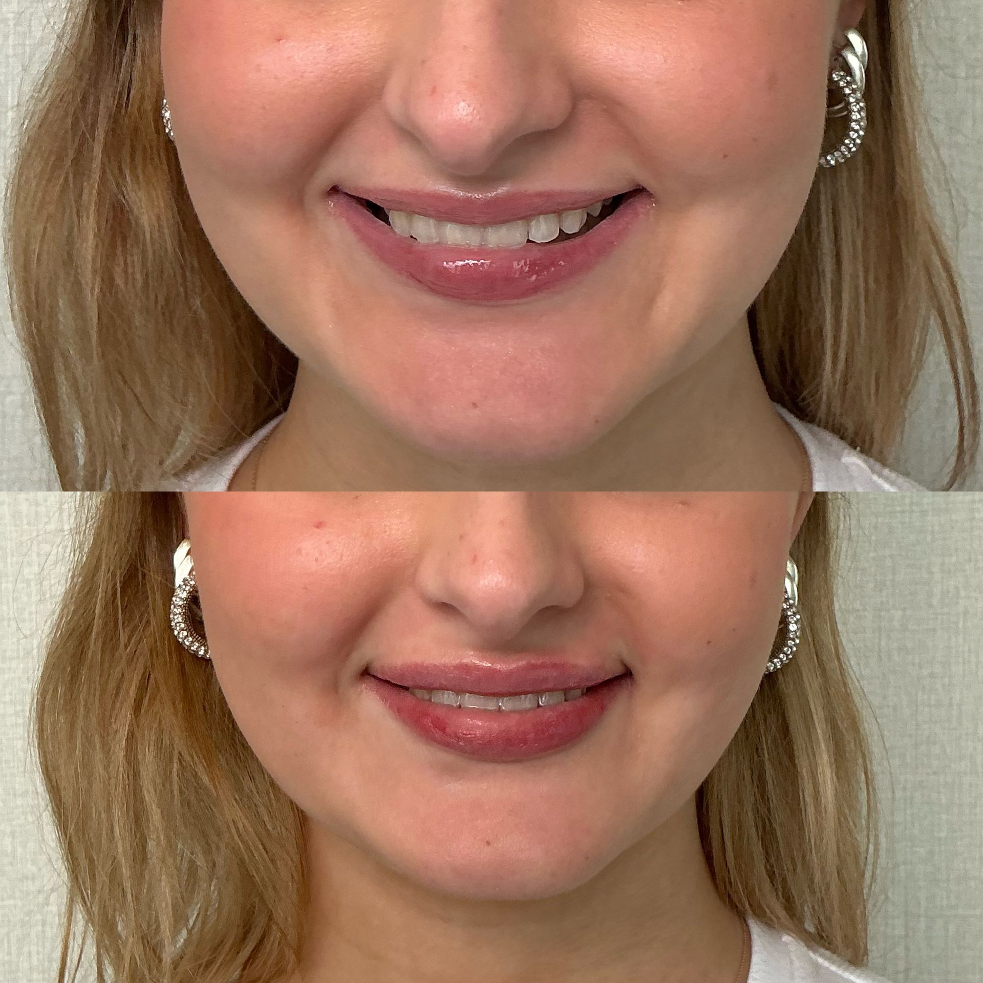Close-up of smiling lips with pink lipstick, shown in two stacked views.