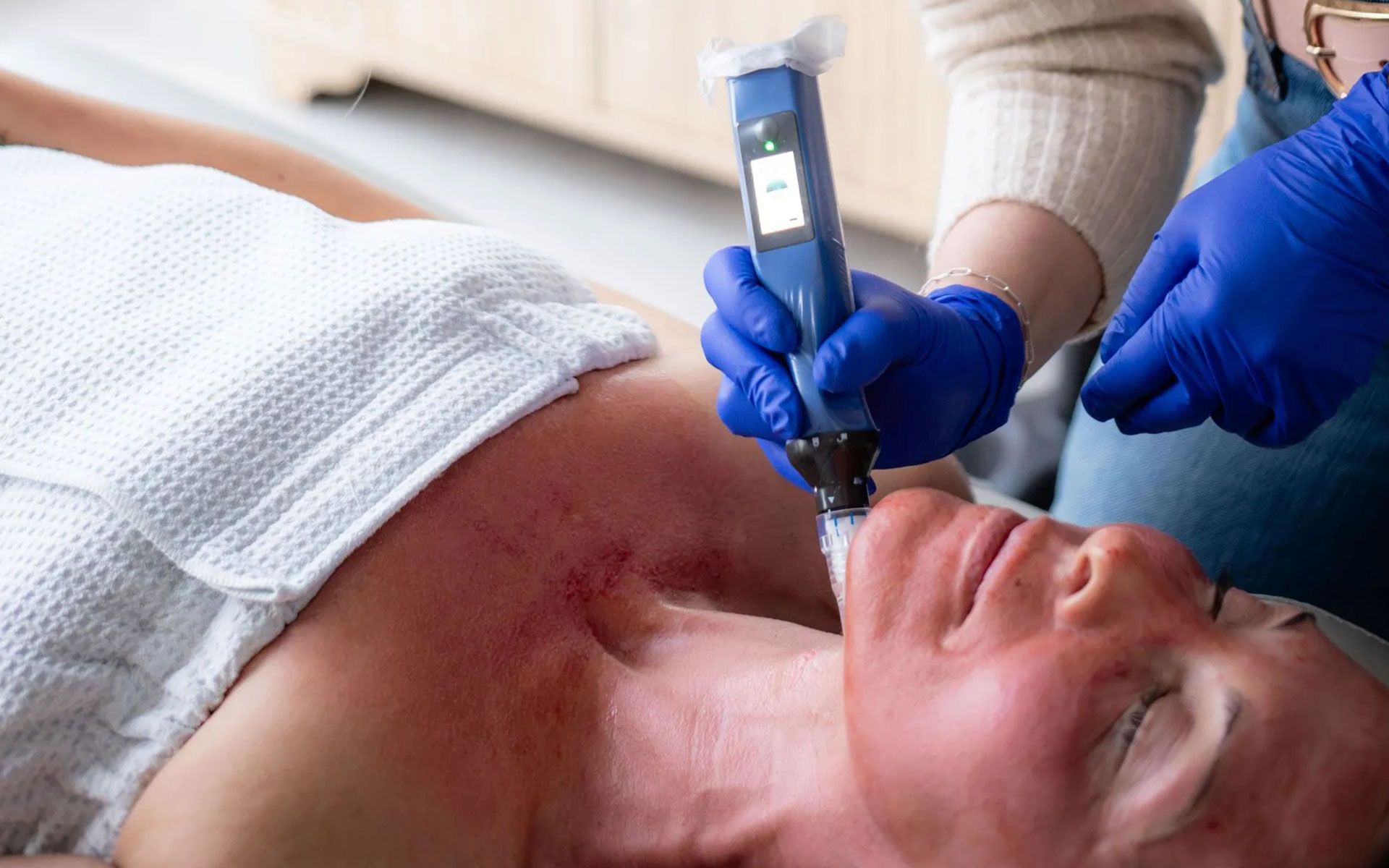 Medical professional performing laser treatment on a patient's neck while they lie on a bed