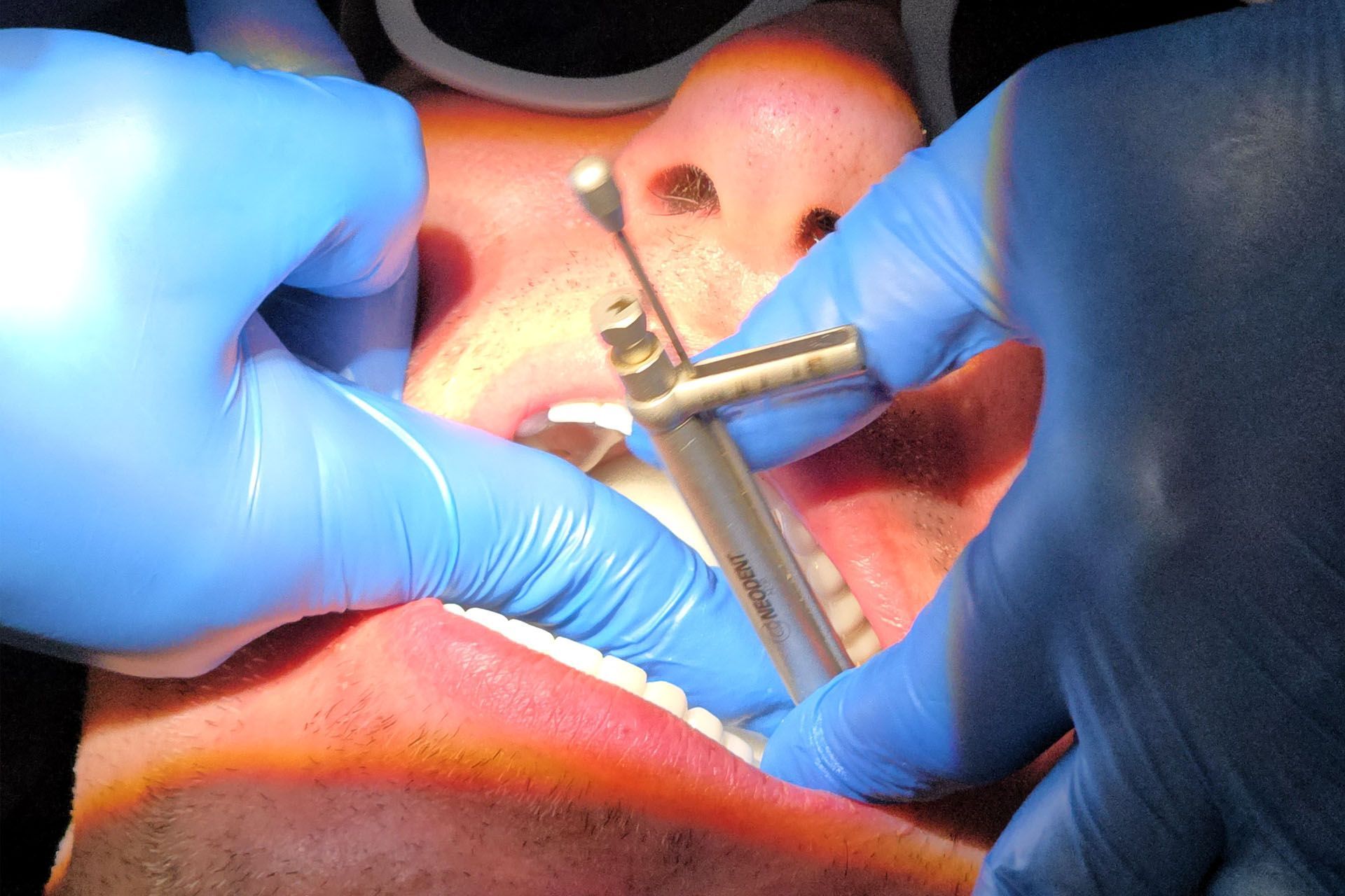 A dentist is using a syringe on a patient's teeth.