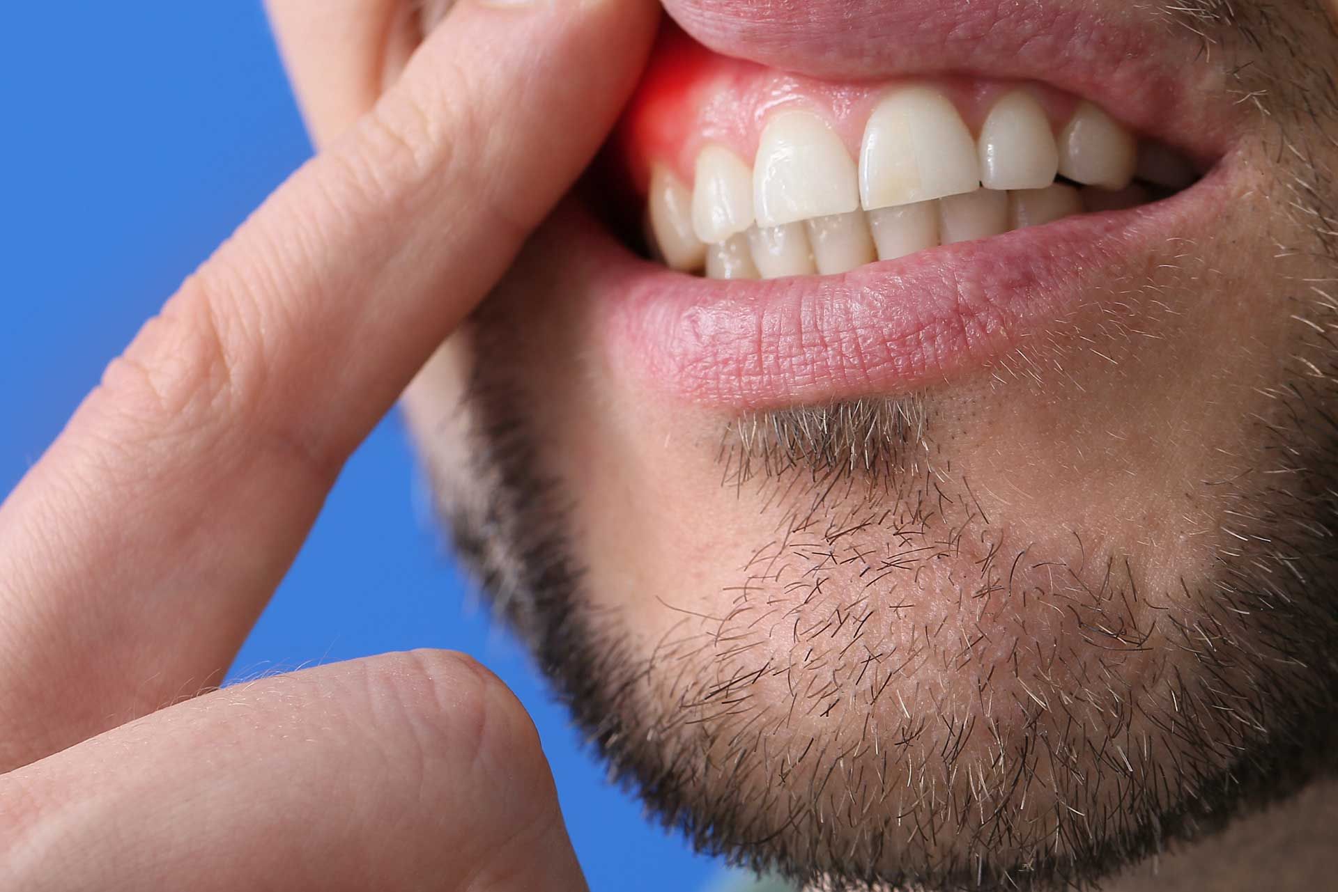 Periodontics services