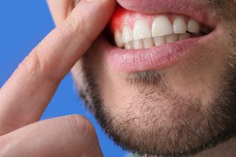 Periodontics services