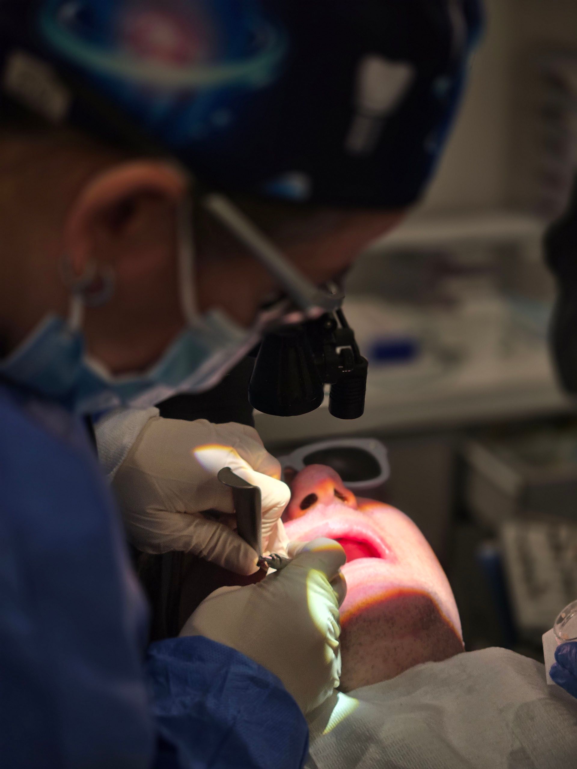 All On Four Implants - A surgeon is working on a patient's face with a magnifying glass.
