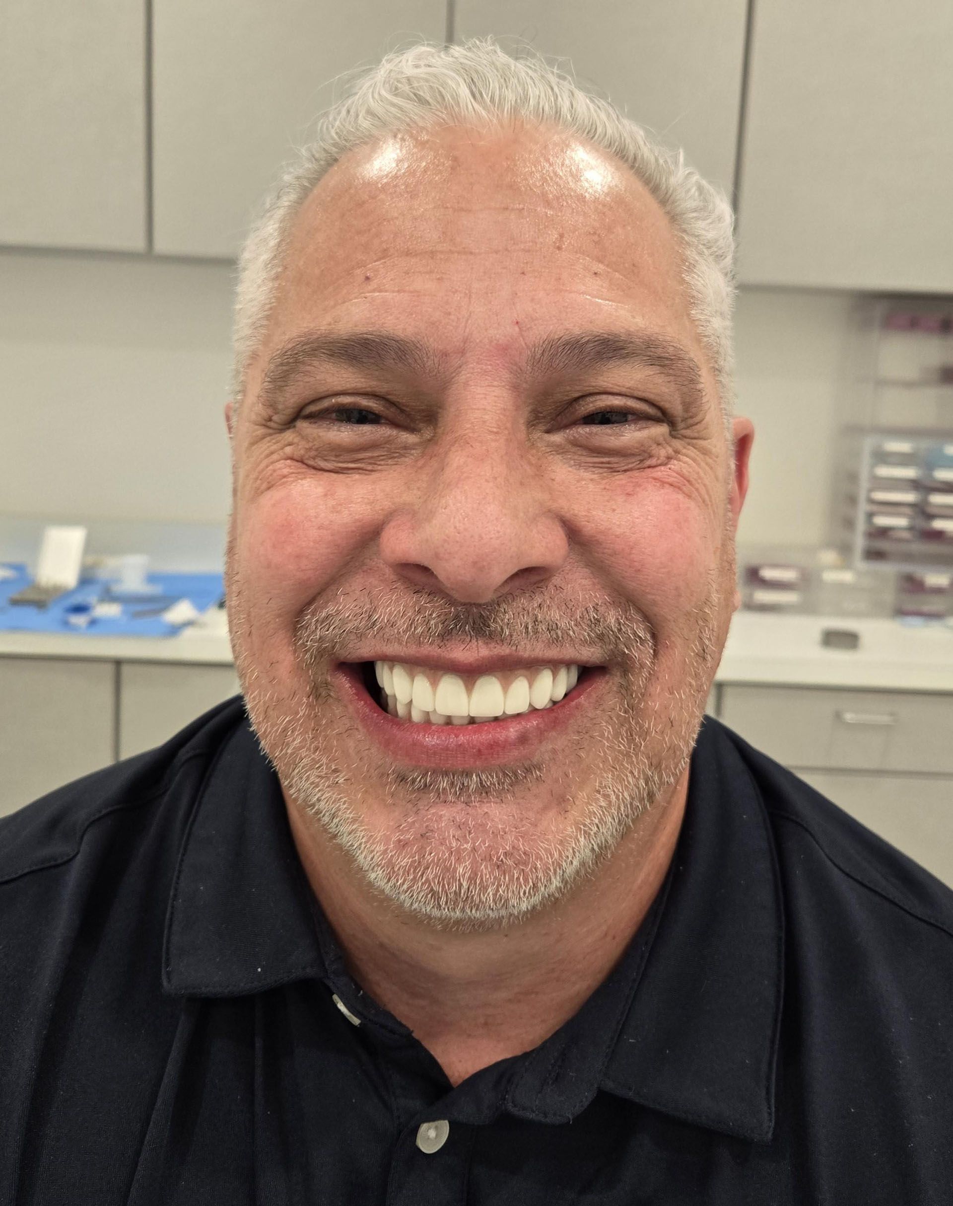 All On Four Implants - A man with a beard and a black shirt is smiling for the camera.