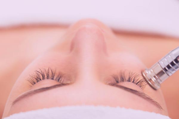 Microdermabrasion Services