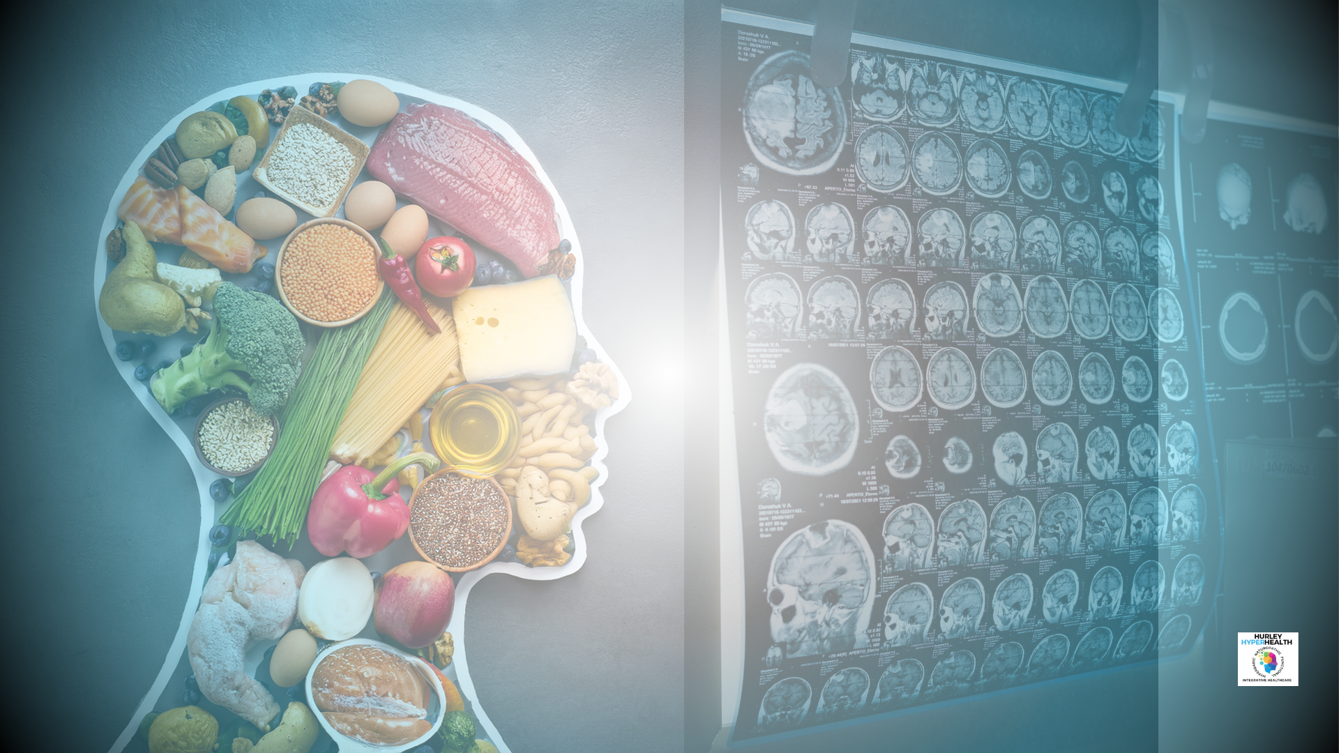 A human head silhouette filled with various whole foods, next to a display of brain scans on a blue background.