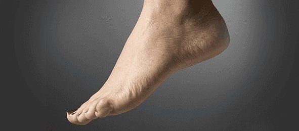 Foot pain | Ozone Park, NY | Vincent Evangelista, DPM | 855-373-1096