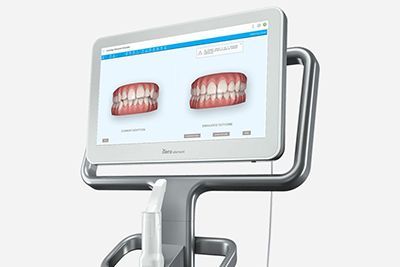 Dental images being displayed on a monitor