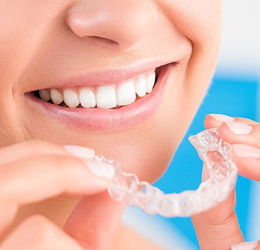 Clear retainers