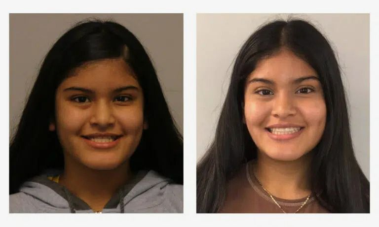 Before and after early orthodontics