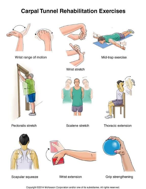 Carpal Tunnel Rehabilitation Exercises