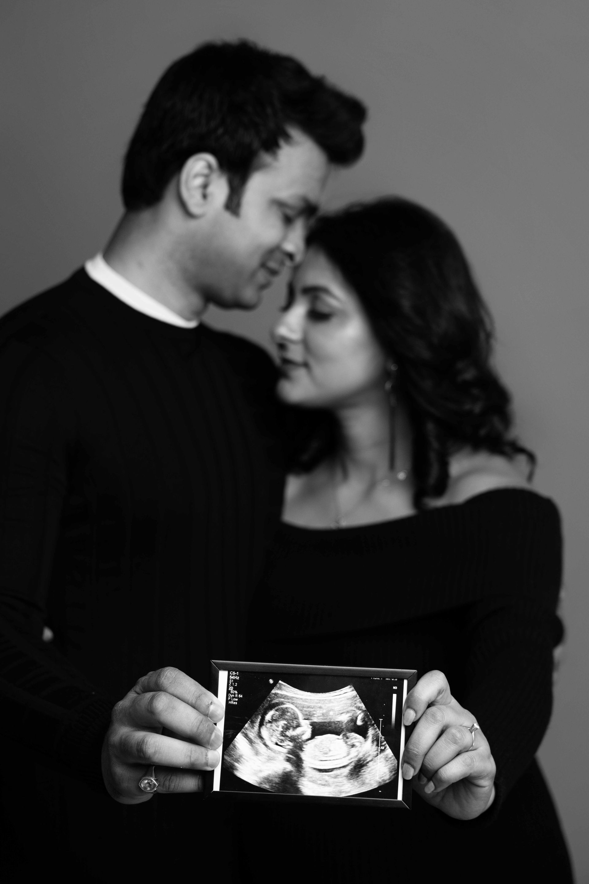 A black and white photo of a man and woman holding an ultrasound