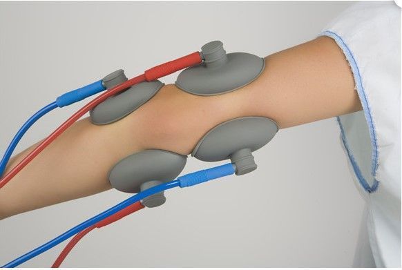 A person 's arm with a bunch of wires attached to it